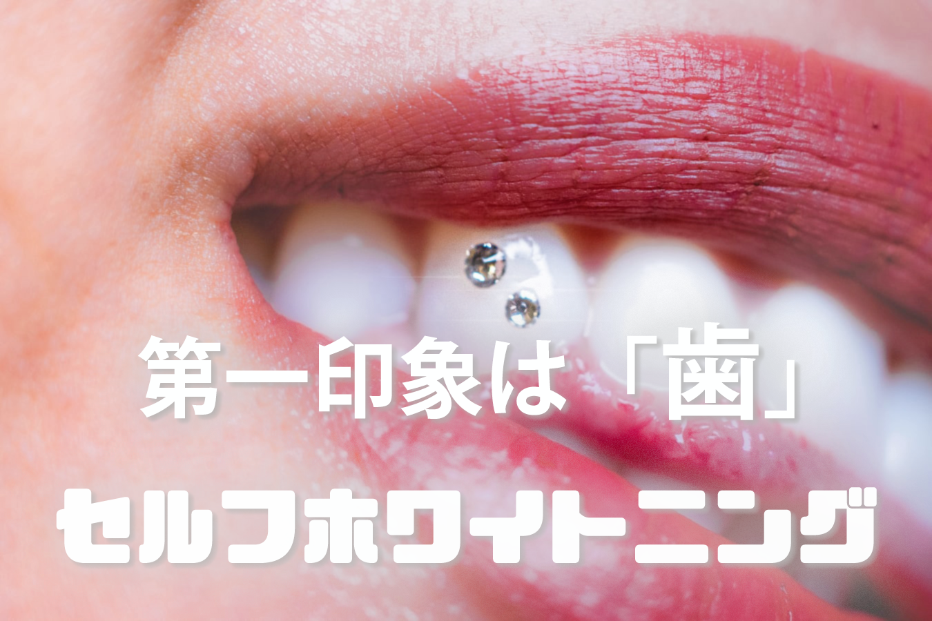 日本未上陸 第一印象は歯 効果抜群 最強セルフホワイトニングのご紹介 Agecode